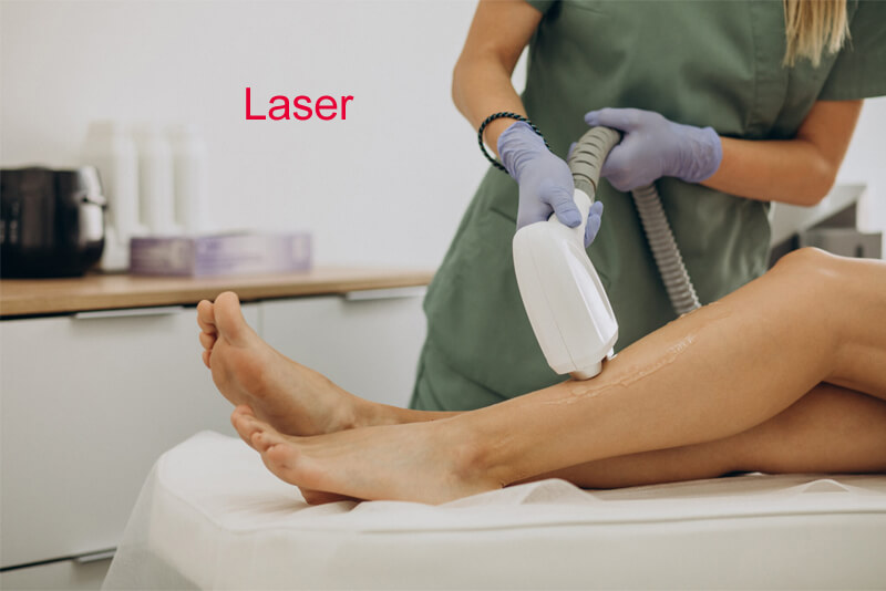 diode laser hair removal machine treatment