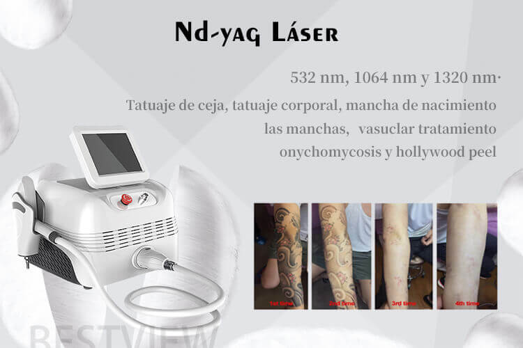 nd yag laser eliminacion tatuajes