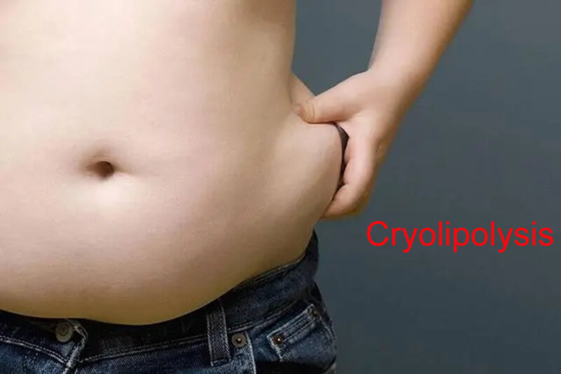 cryolipolysis slimming machine-2